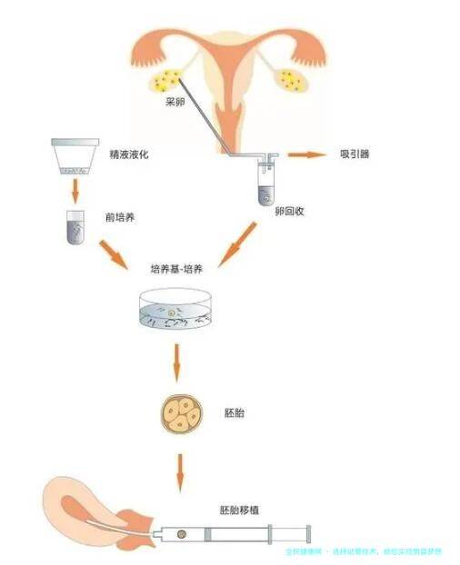 选择试管技术，助您实现男婴梦想