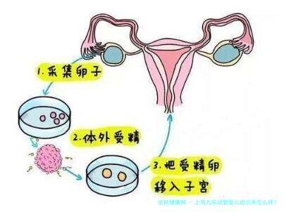 上海九院试管婴儿成功率怎么样？