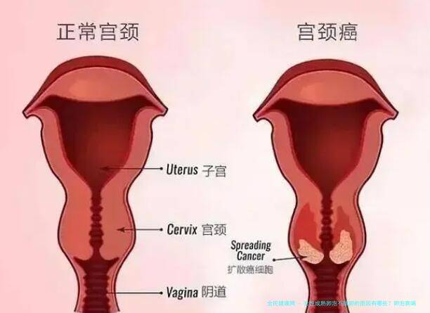 女性成熟卵泡不排卵的原因有哪些？卵泡衰竭影响瀑排卵有哪些解决方案？