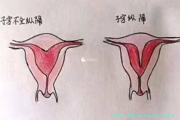 泰国做试管婴儿哪个医院好？附3代试管的费用明细