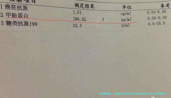 探索纽约康奈尔大学的试管婴儿技术与最新研究