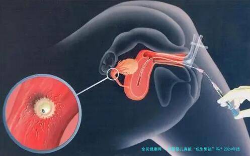 试管婴儿真能“****”吗？2024年技术现状与伦理争议全解析