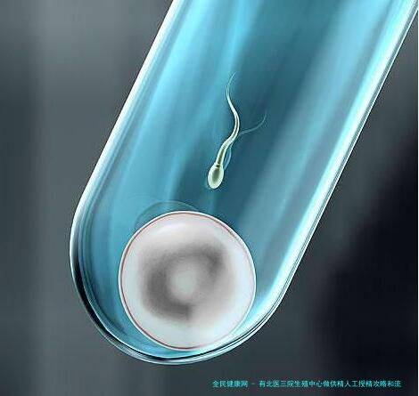有北医三院生殖中心做**人工授精攻略和流程吗？