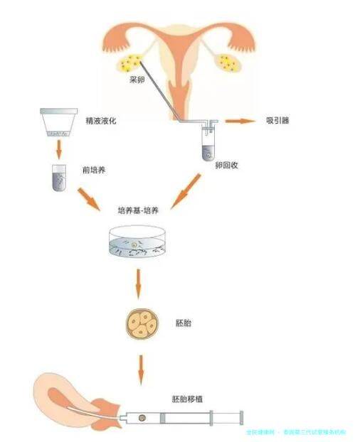 泰国第三代试管服务机构
