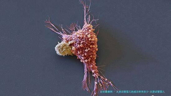 太原试管婴儿的成功率有多少-太原试管婴儿费用大约多少2020年！