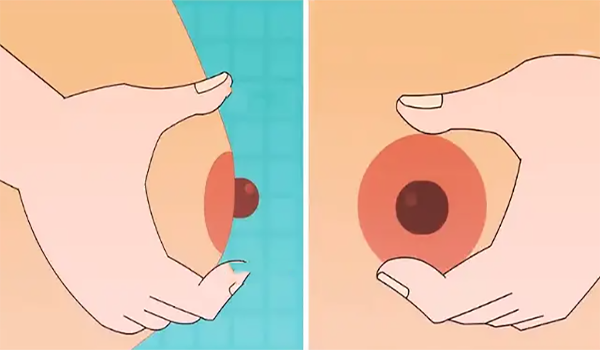 怀**的乳房会比较大
