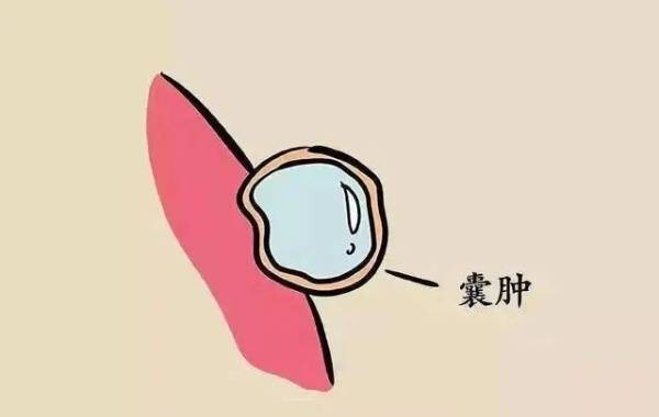 女性病理性卵巢囊肿较严重可以做三代试管怀孕吗？