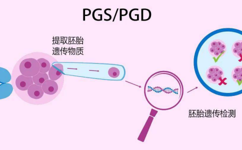 泰国和美国使用的是第几代试管婴儿技术？