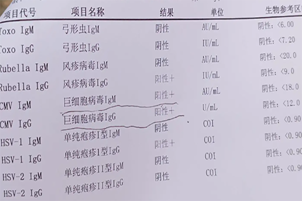 巨细胞病毒会终身携带