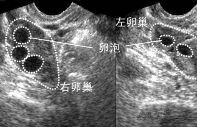 卵泡大小不同会影响**