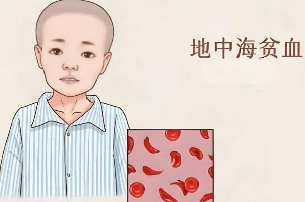 医疗技术水平会影响地贫试管的成功率