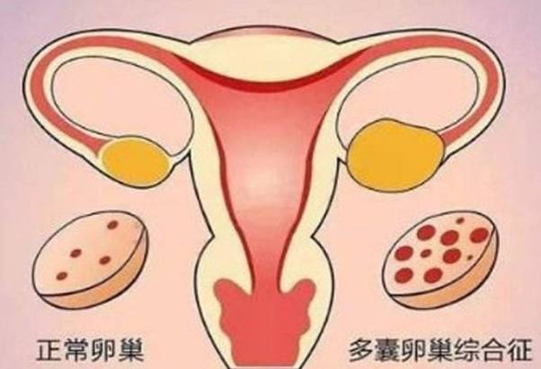 试管过程中会伴随心理压力