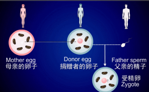 关于四代试管婴儿的科普，第四代试管婴儿技术又叫卵浆置换技术