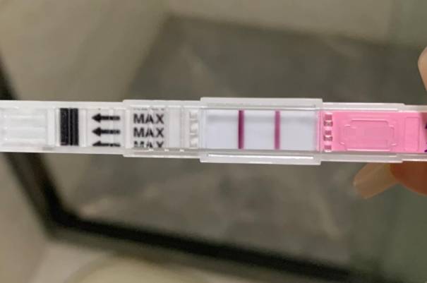多囊患者会影响排卵试纸强阳的显现