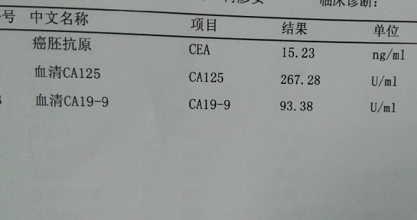 ca125异常不能进入试管周期