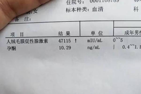 从多少周开始就不怕孕酮低不需要再吃黄体酮保胎了？