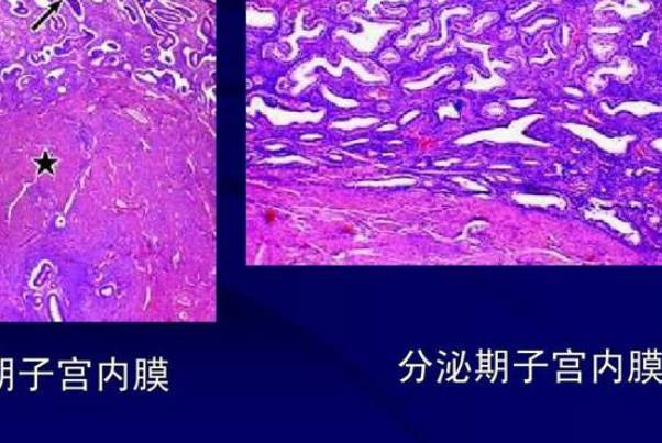 子宫内膜4.5mm有褐色分泌物原因汇总，想成功怀孕生子看这