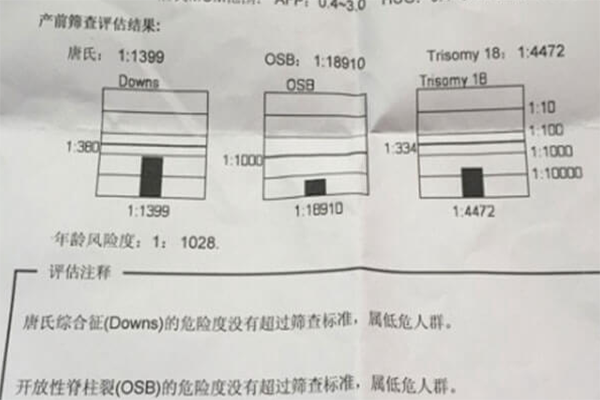 孕期做唐氏筛查的通过率很高