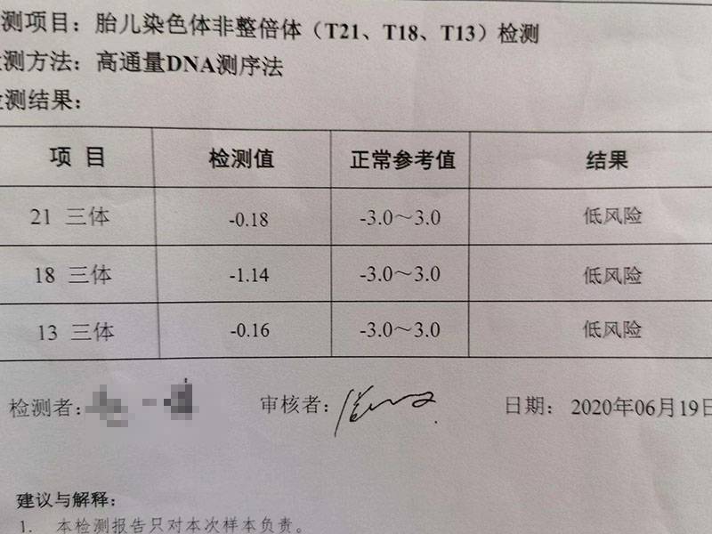 三代试管有必要做无创dna升级plus版替代羊穿吗？