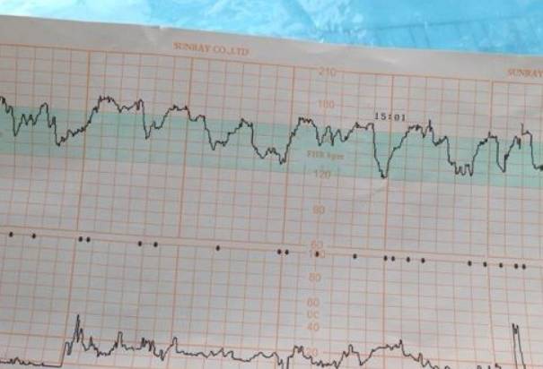 孕16周胎心率每分钟142次是男丁几率高还是女儿概率大呢？