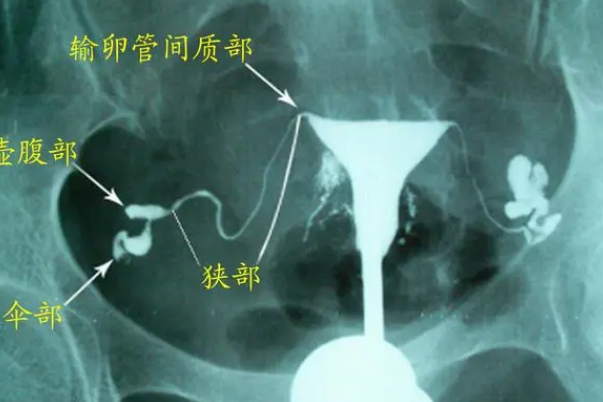 查完输卵管显示正常后一般多久可以进入试管周期？