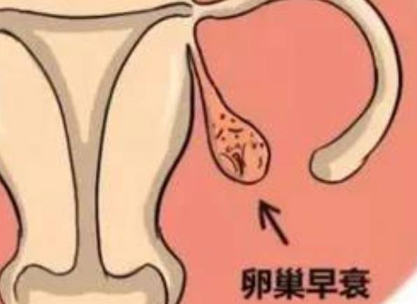 amh值一般多少ng/ml为卵巢早衰当结果为0.01时还能治疗吗？