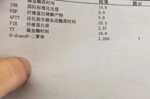 D2聚体高会影响胚胎顺利着床