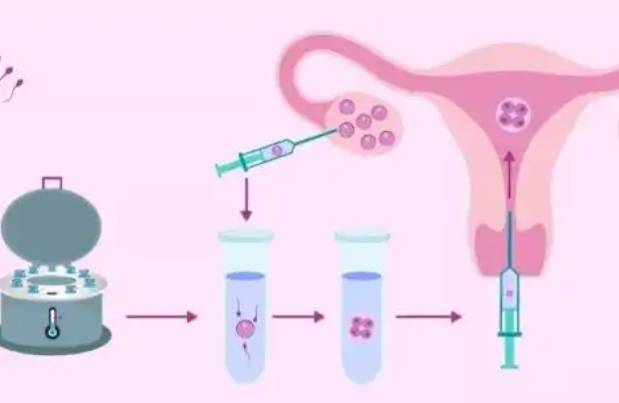 第二胎试管移植胚胎的步骤分享，做好准备其实很简单