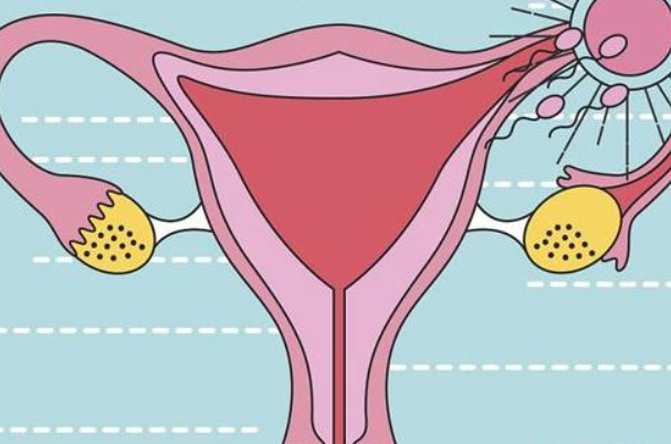 排卵障碍分为一型、二型和三型