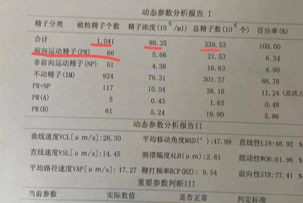 男性备孕检查必做精液检查
