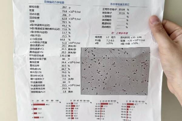 备孕检查精液分析可以判断男性生育能力