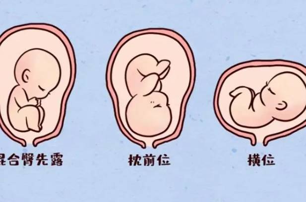 胎儿横位大多是男宝这种说法准确吗？