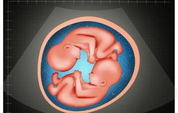 网传试管双绒双羊必须37周用剖腹产结束妊娠是真的吗？