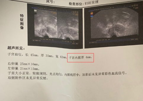 移植前内膜薄需要连续做几次宫腔灌注手术才有效？