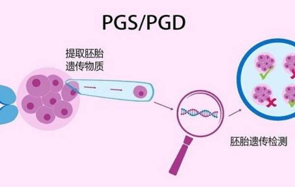 三代试管婴儿pgd筛查后胚胎还会出现染色体问题吗？