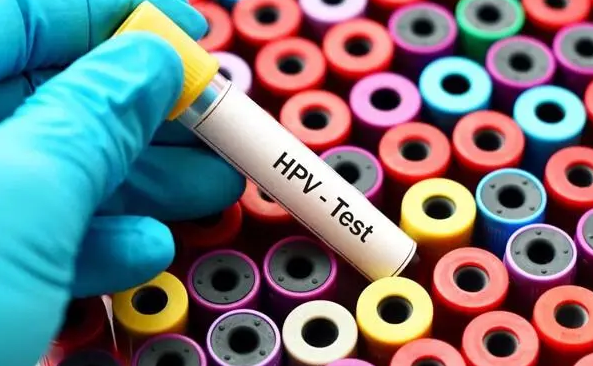 为什么网上大部分人都不建议30岁以下的女性去医院检查hpv?