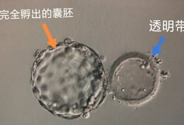 养囊能提高试管成功率