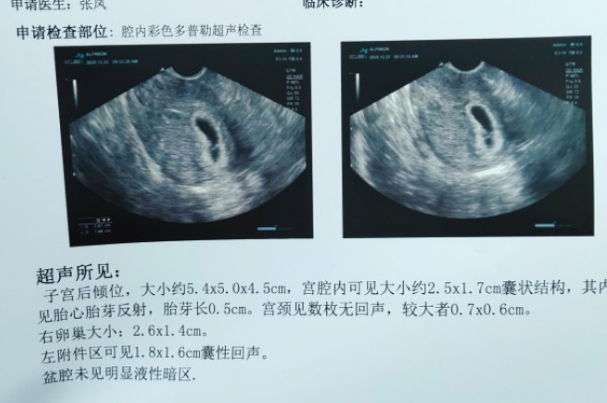 做B超时医生说胎儿活跃是暗示会生一个儿子吗？