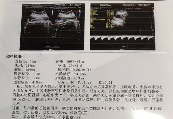 去公立医院给胎宝宝做一次五维彩超多少钱？