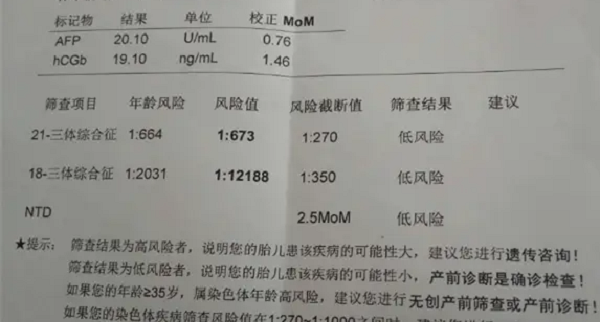 宝宝唐筛21三体高风险与老公有没有关系?