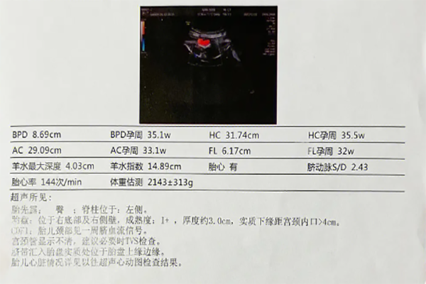 hc与ac的比值为1