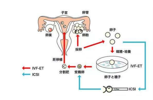 胚胎移植是一个复杂精密的过程