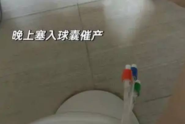 分娩塞球囊可以催产