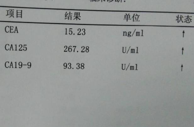 ca125偏高会影响试管移植