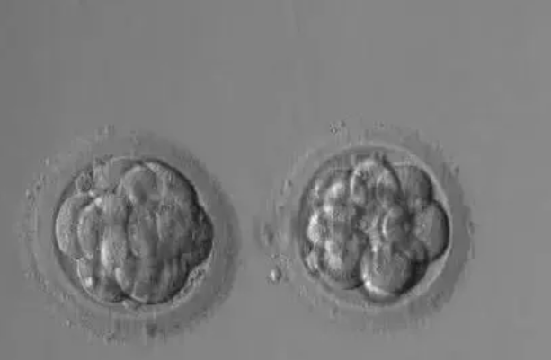 鲜胚移植成功率因人而异