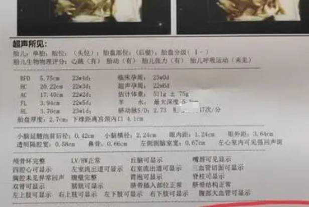 22周大排畸各项参考值一览表，宝宝发育情况就看这