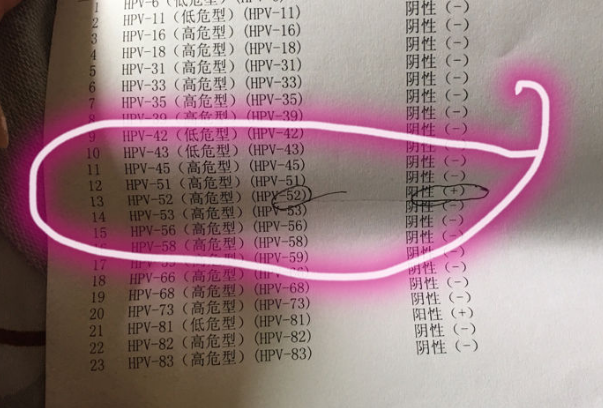 女性患者HPV52阳性能继续做试管促排卵治疗吗？