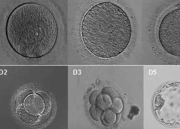 第一次移植三级胚胎成功率有多高？