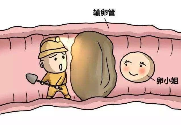 女性输卵管不通不孕