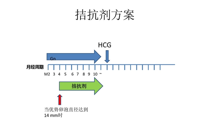 尝试做试管医生建议用试管拮抗剂方案是什么意思？